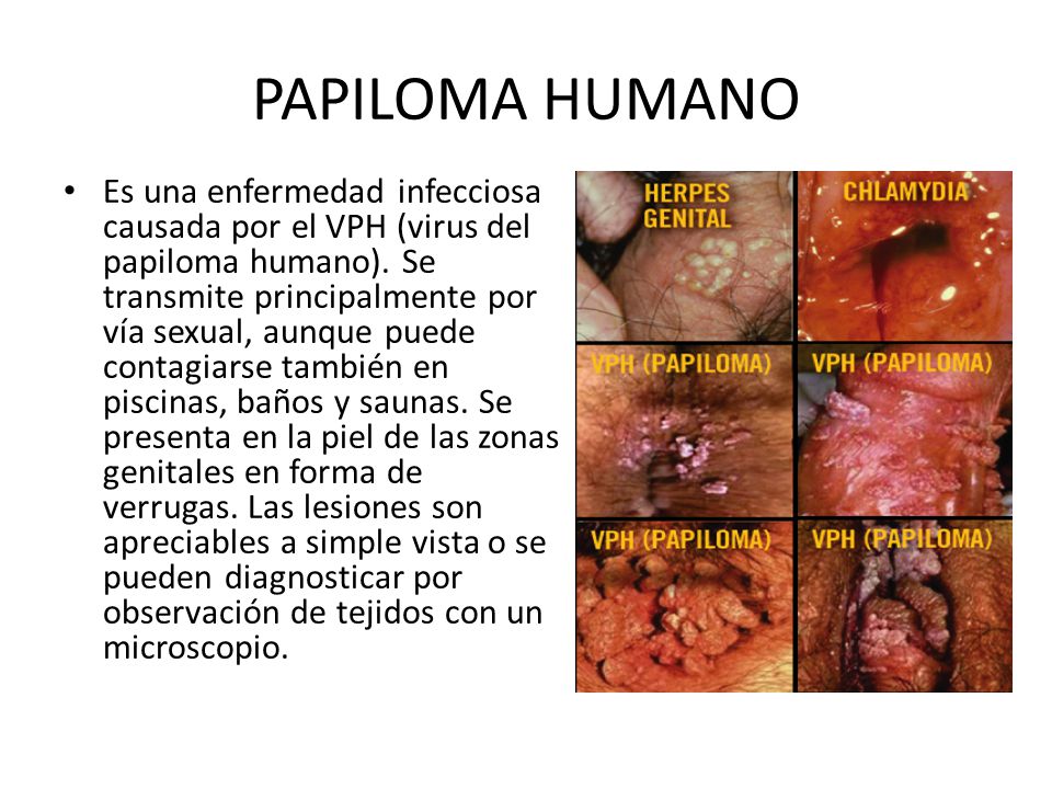 La eccema en las manos el tratamiento gratis